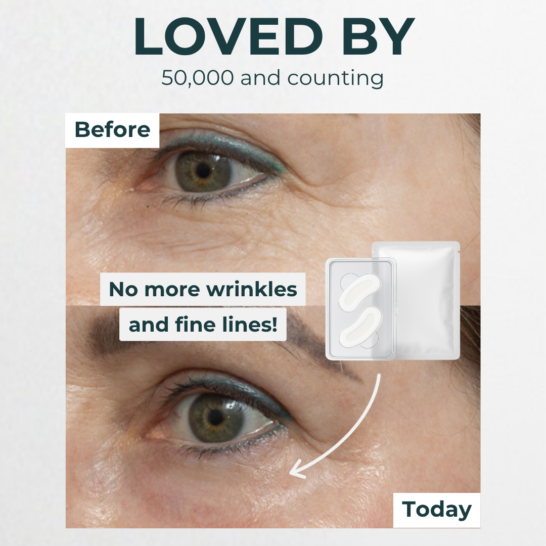 Microneedle Hyaluronic Acid Under-Eye Patches