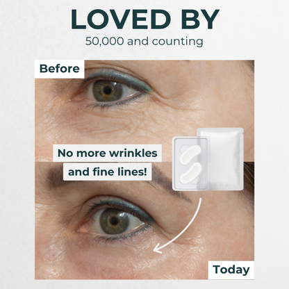 Microneedle Hyaluronic Acid Under-Eye Patches